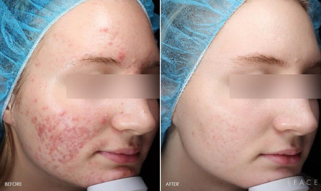 FACE Skincare Medical Wellness in Bingham Farms, MI (5)