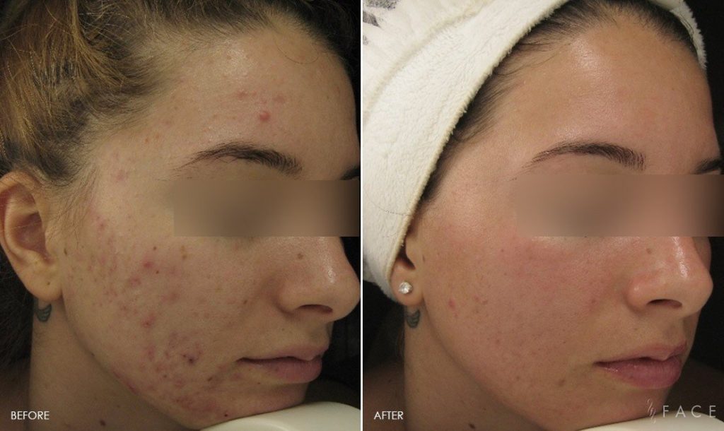 FACE Skincare Medical Wellness in Bingham Farms, MI (6)