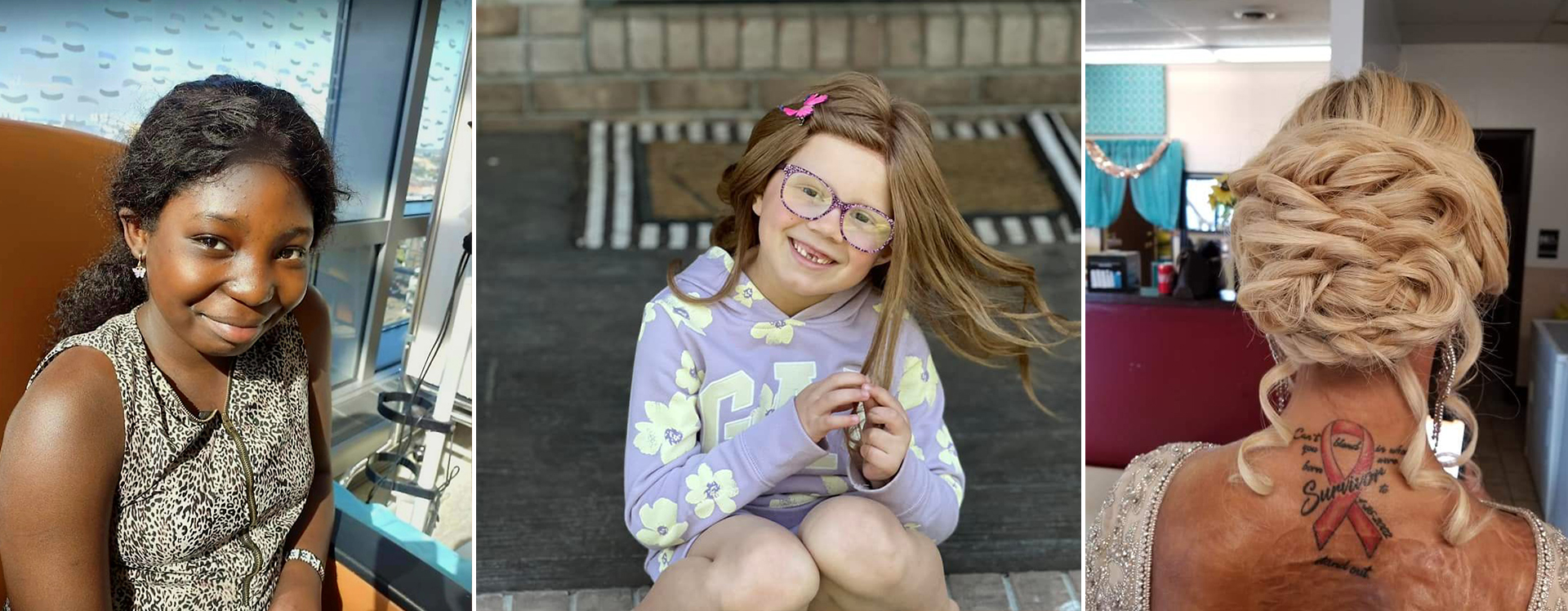 Children With Hair Loss in South Rockwood, MI (3)