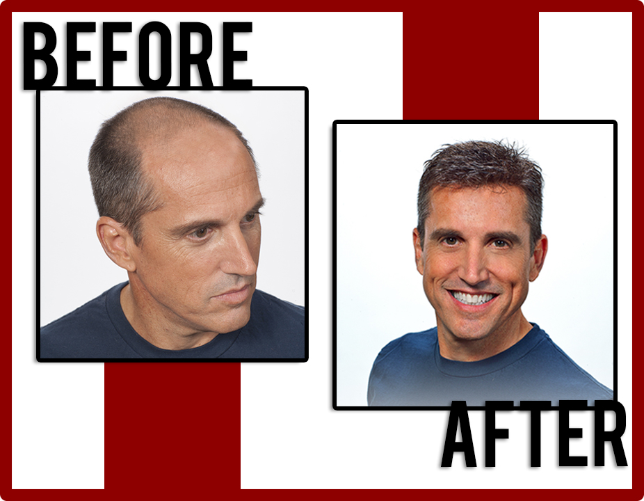 Usadel's Hair Force/Hair Replacement in Sheboygan, WI (2)