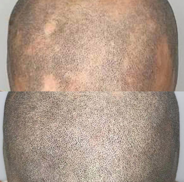 Primped 365, Permanent Makeup and Wigs in Christiansburg, VA (2)