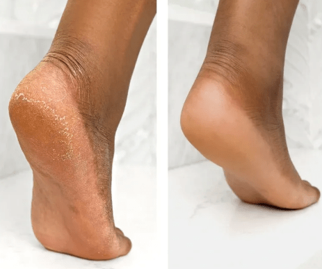 Compassionate Soles in Hurst, TX (3)