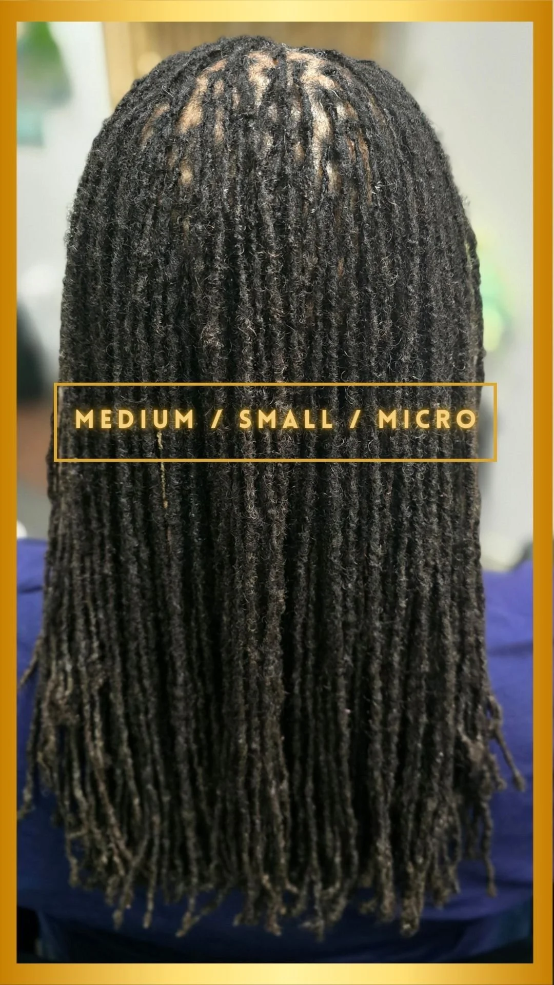 DevaStyles Hair Restoration Clinic in Plano, TX (6)