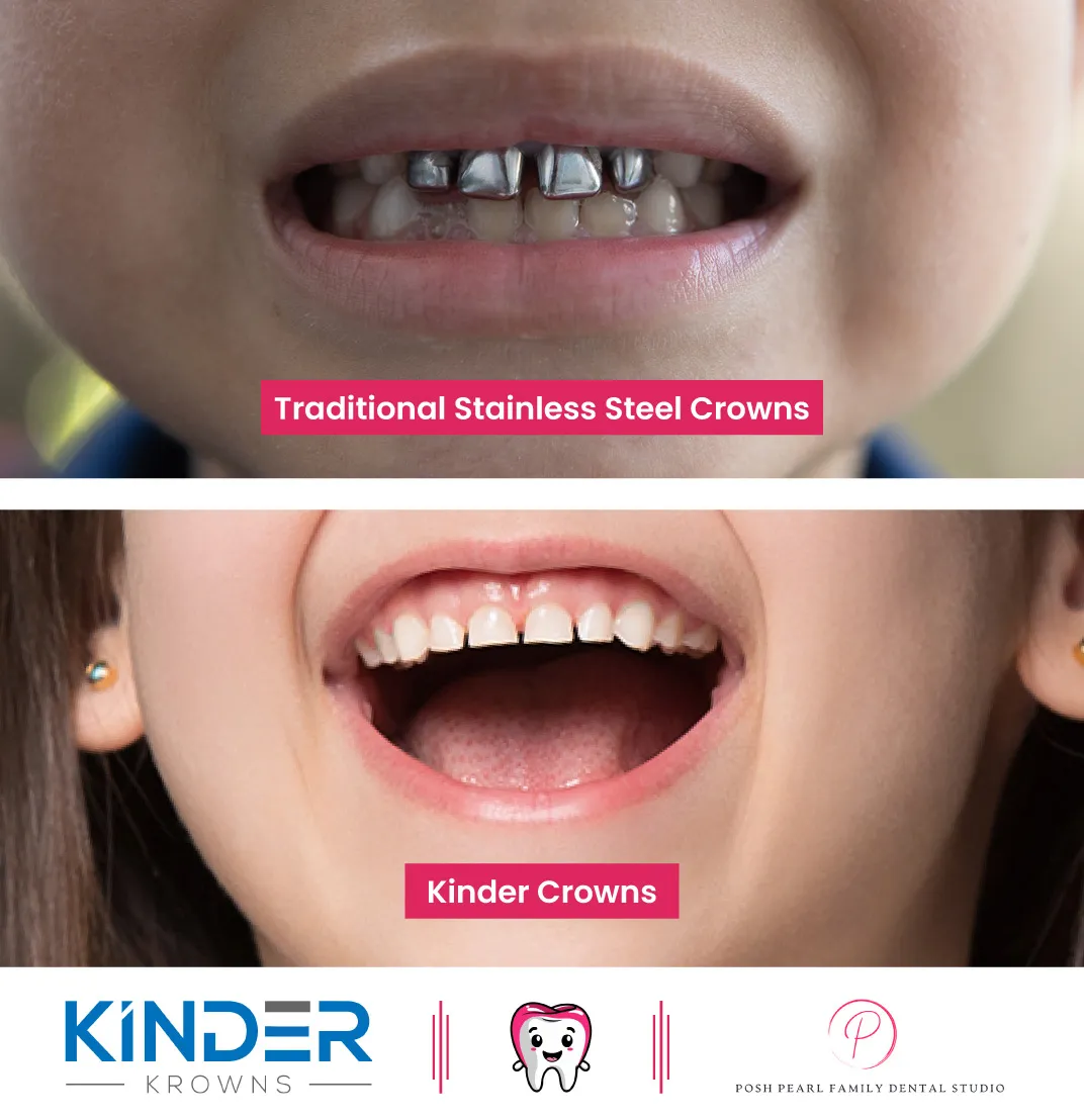 PoshPearl Family Dental Studio in Yucaipa, CA (4)