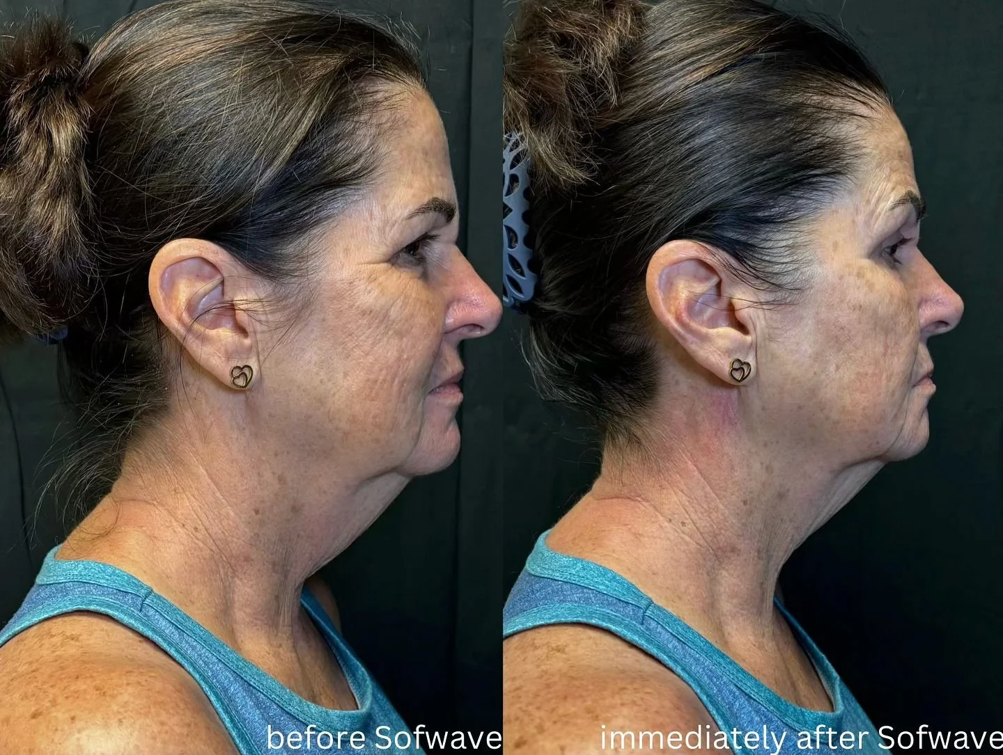 DT Beauty Microblading and Tattoo in Stuart, FL (2)