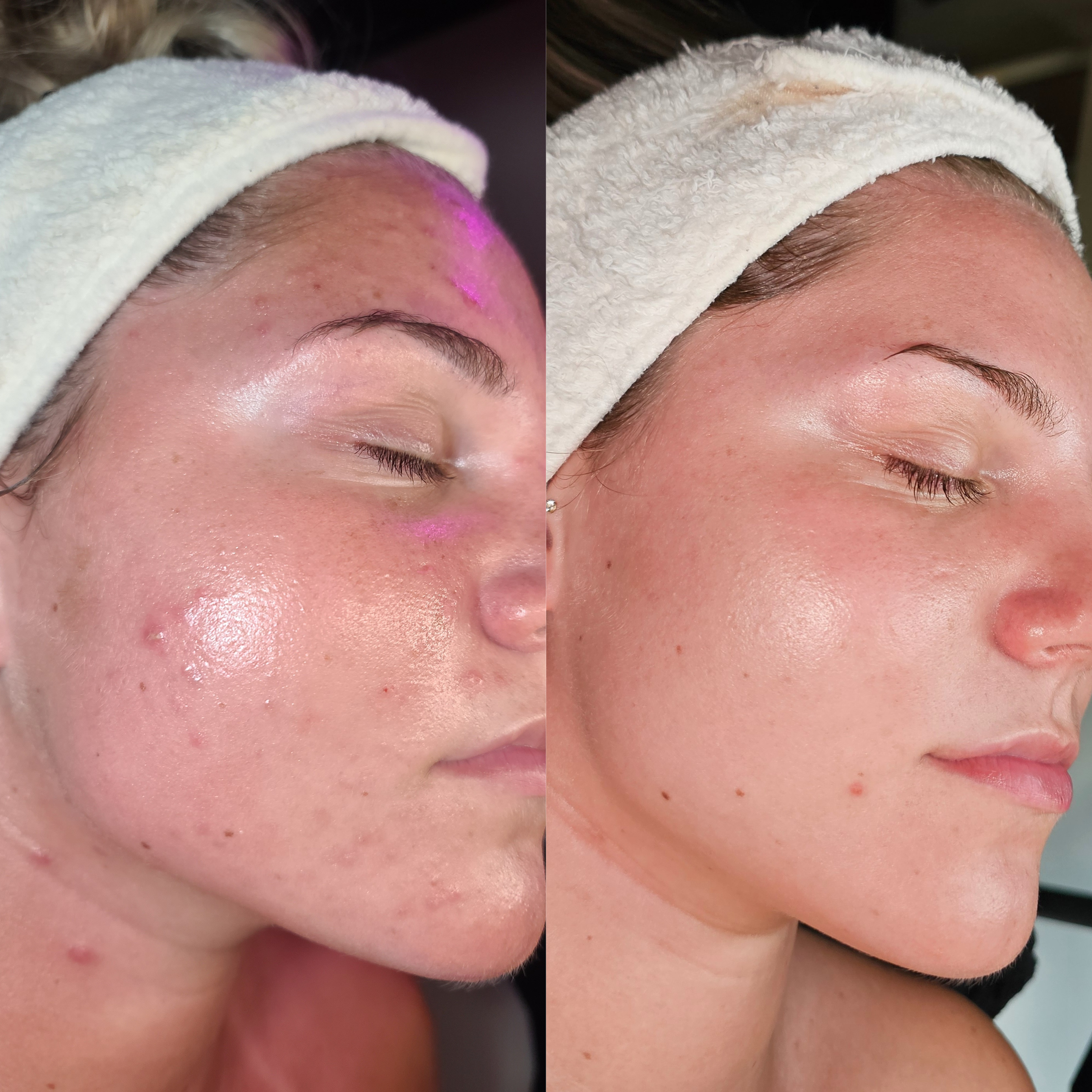 Simply Skin Aesthetics in New London, WI