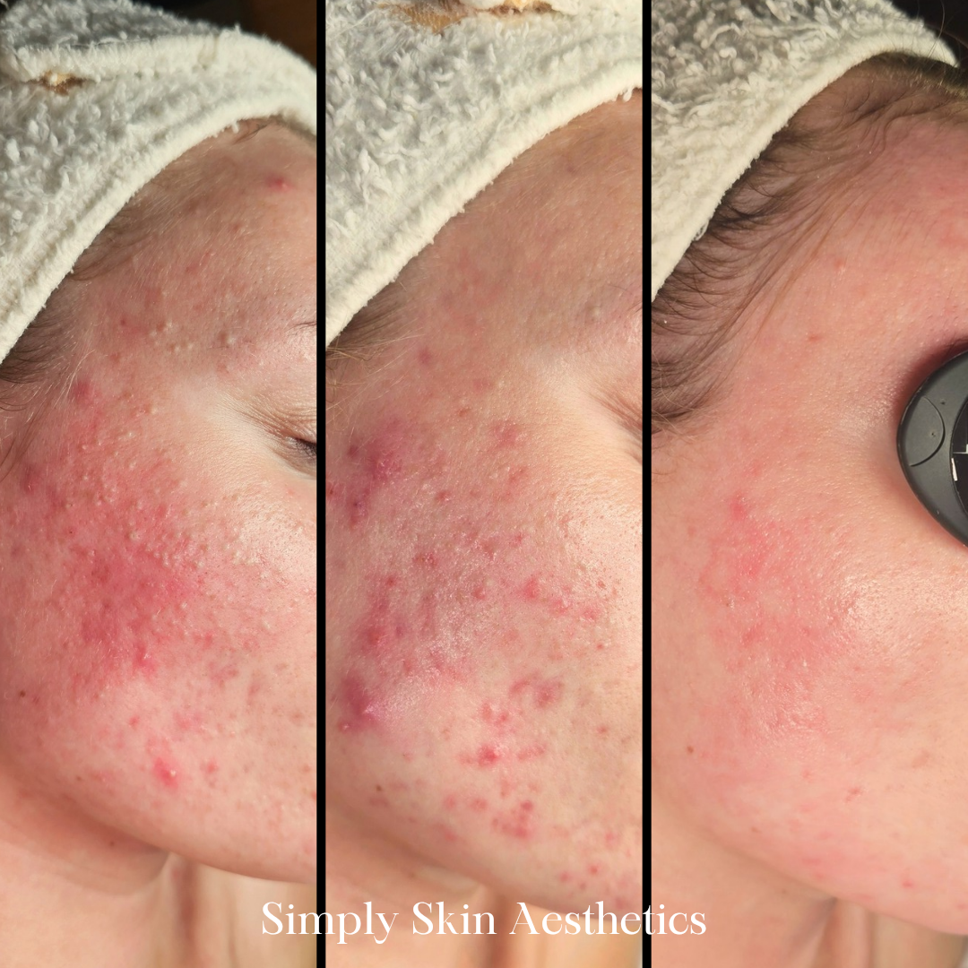 Simply Skin Aesthetics in New London, WI (3)