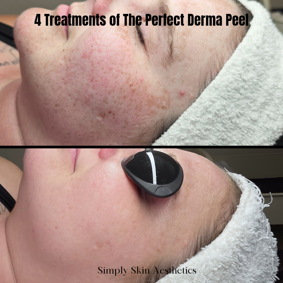 Simply Skin Aesthetics in New London, WI (4)