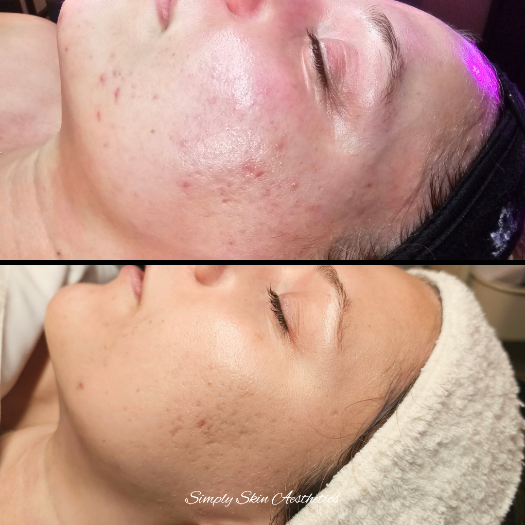 Simply Skin Aesthetics in New London, WI (5)