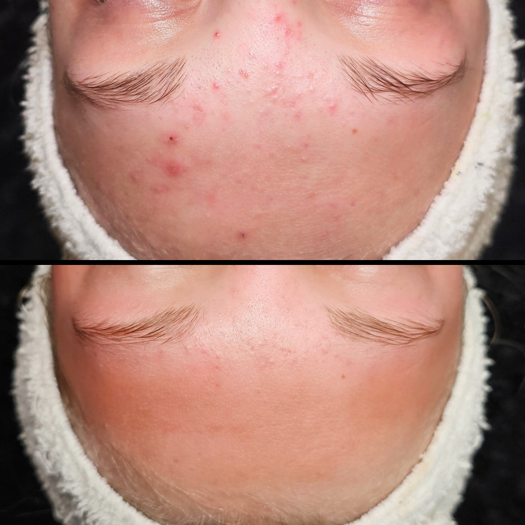 Simply Skin Aesthetics in New London, WI (6)