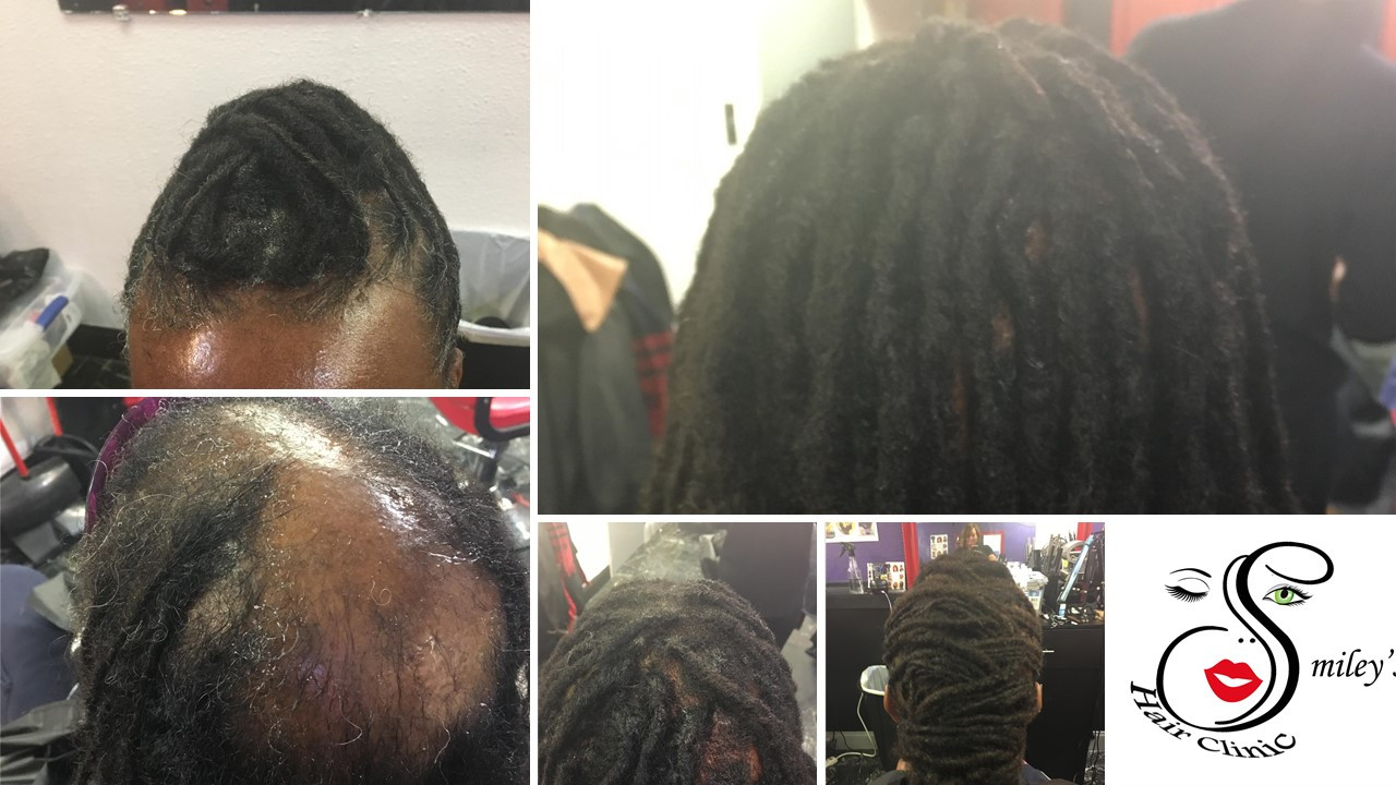 Smileys Hair Clinic in Tucker, GA (3)