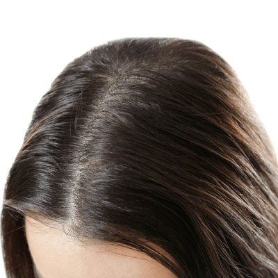 The Hair Growth Club by Original Hair Spa in Berkley, MI