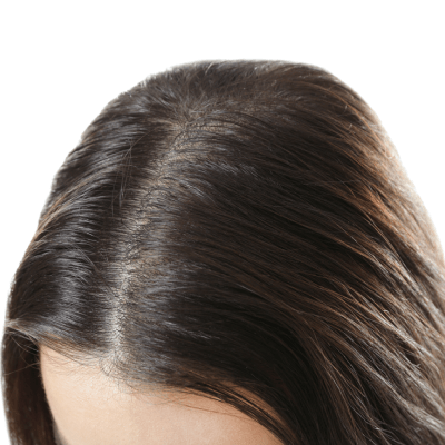 The Hair Growth Club by Original Hair Spa in Berkley, MI (2)