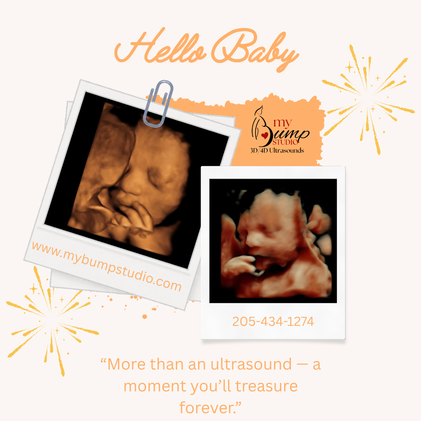 My Bump Studio 3D 4D, Hueytown in Hueytown, AL (2)