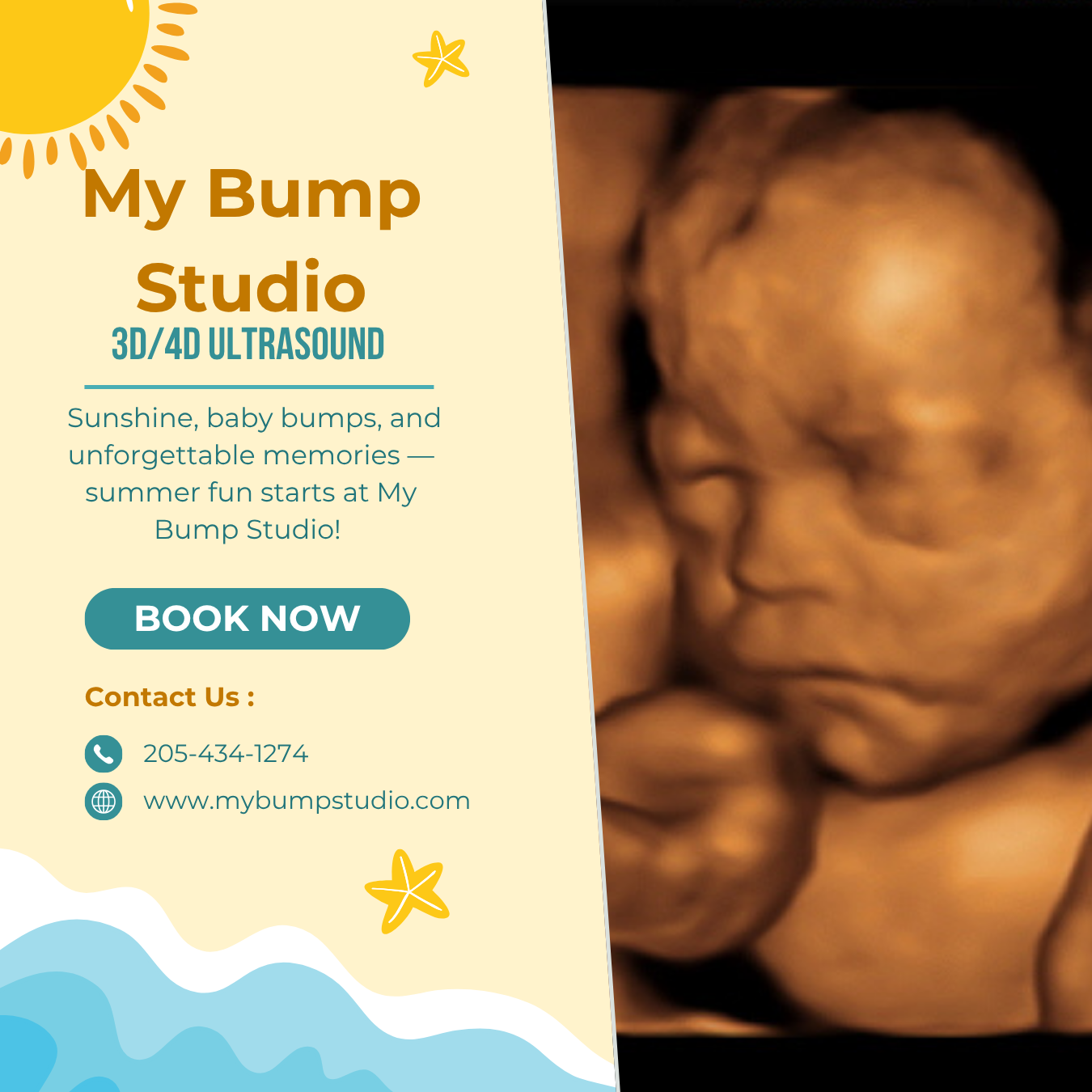 My Bump Studio 3D 4D, Hueytown in Hueytown, AL (3)