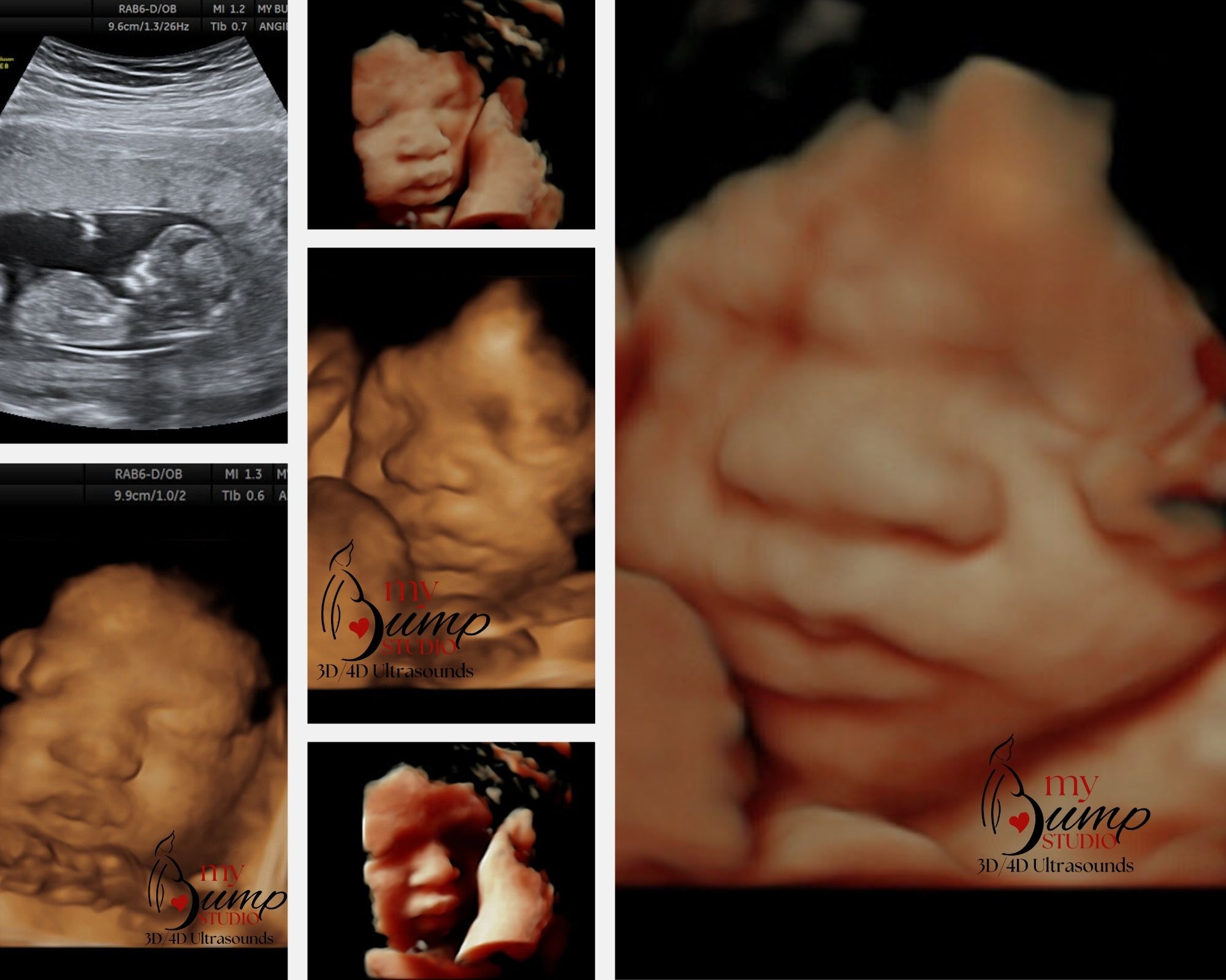 My Bump Studio 3D 4D, Hueytown in Hueytown, AL (6)