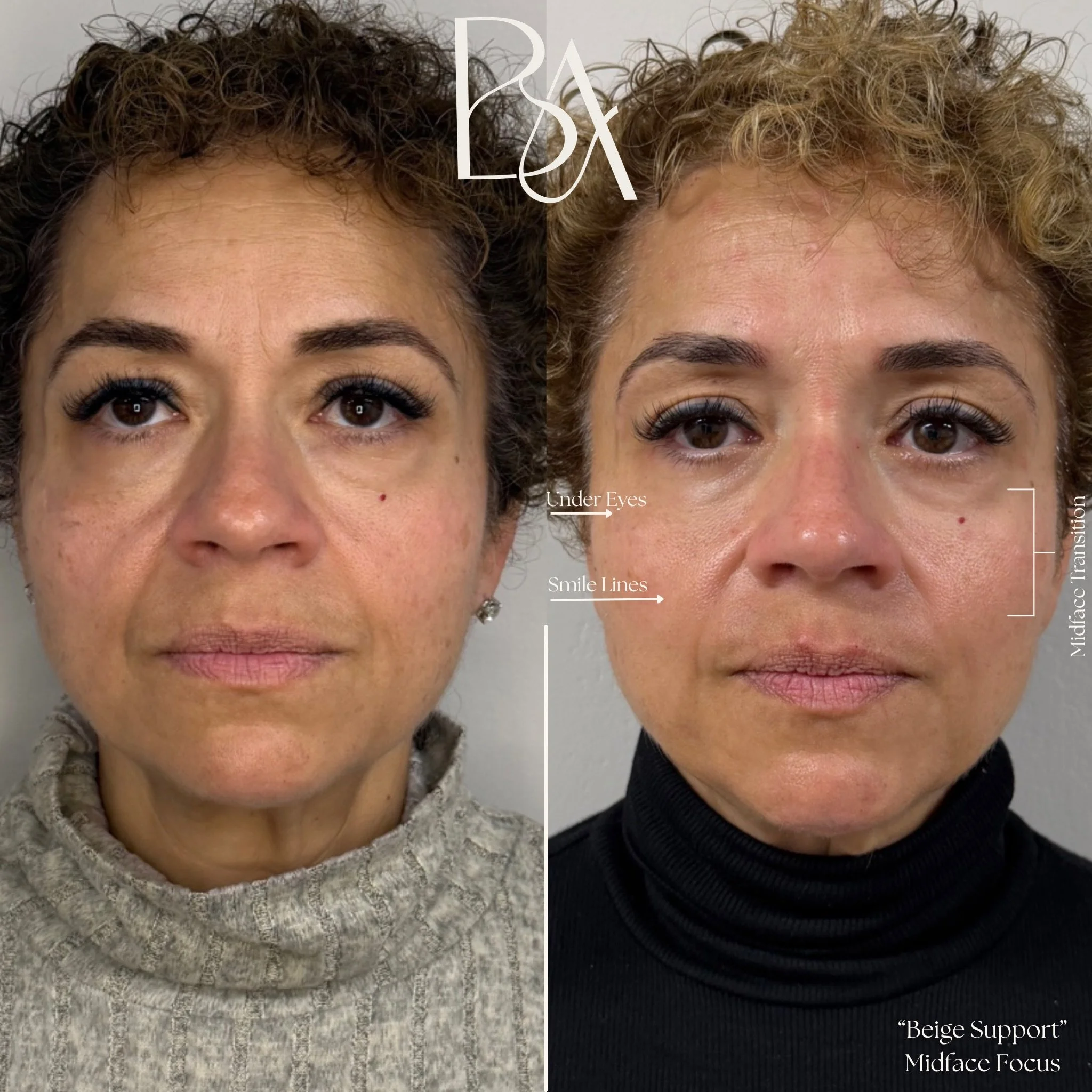 Beige Atelier Regenerative & Aesthetic Medicine in Annapolis, MD (3)