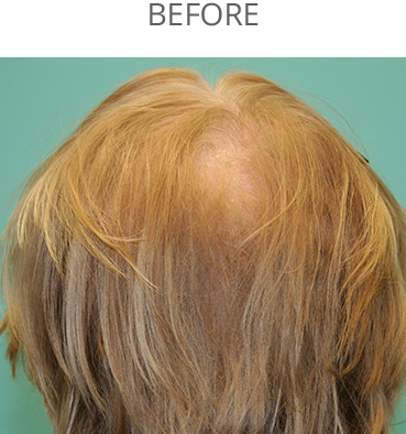 Hair care by Dawn in Vallejo, CA