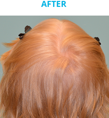 Hair care by Dawn in Vallejo, CA (2)