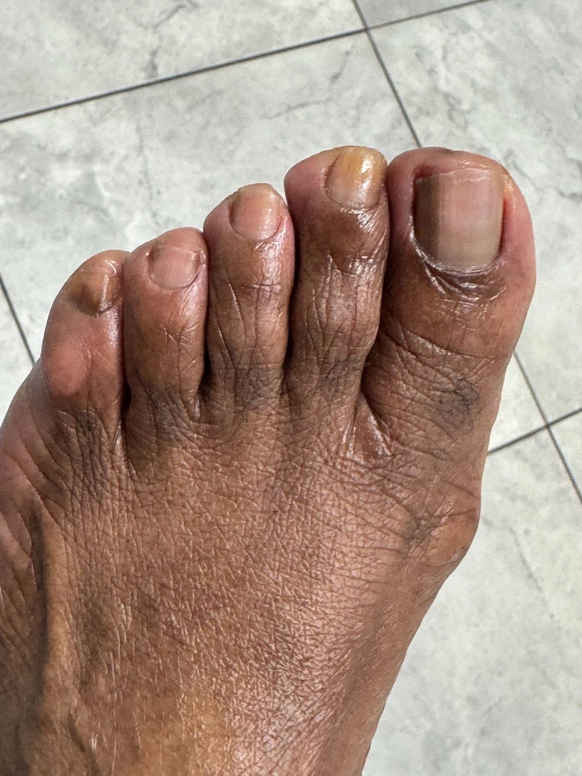 Wellness Pedicures in Davie, FL