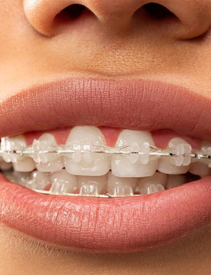 Schoolhouse Orthodontics, LTD: Tasha Bolden, DMD, MSD in Nazareth, PA (2)