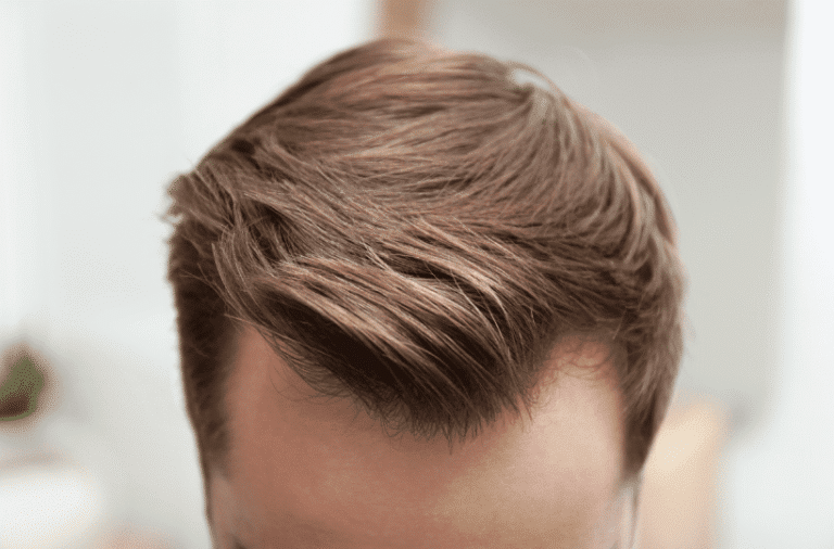 Best Hair System in Rancho Cucamonga, CA (5)