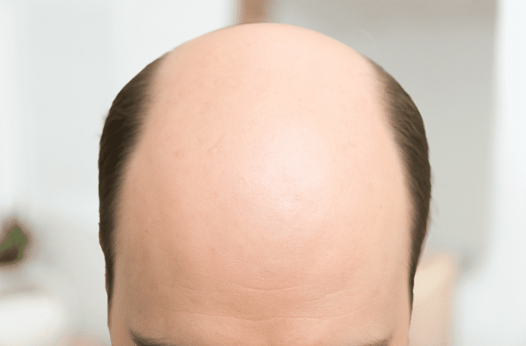 Best Hair System in Rancho Cucamonga, CA (6)