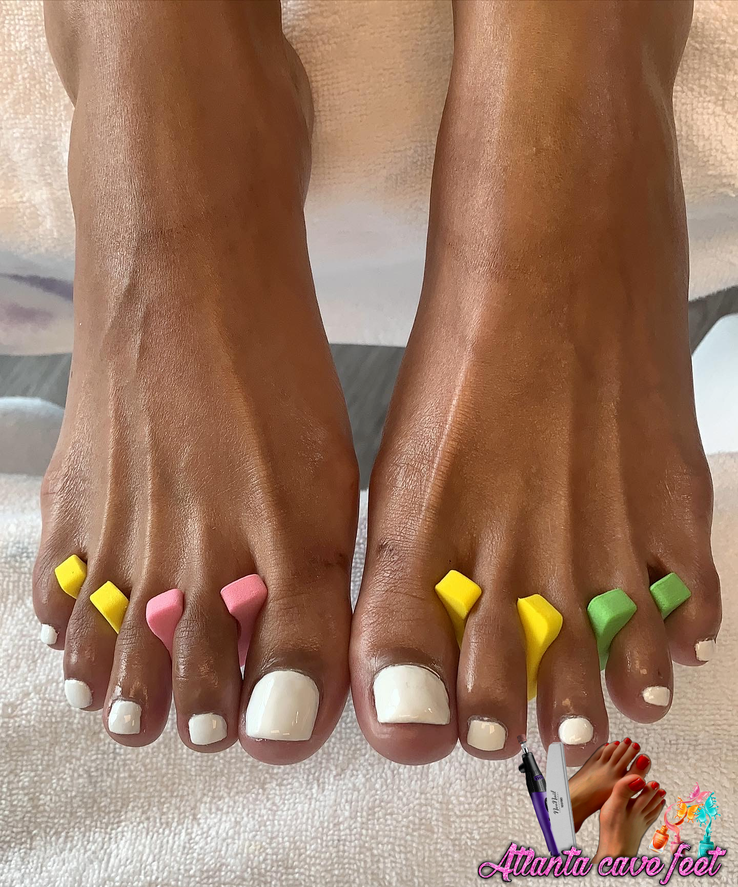 Atlanta Cave Feet Medical Pedicures in Acworth, GA (2)