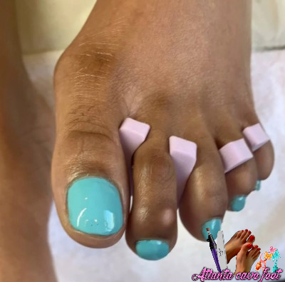 Atlanta Cave Feet Medical Pedicures in Acworth, GA (3)