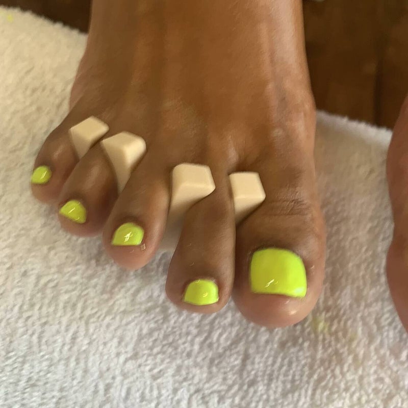 Atlanta Cave Feet Medical Pedicures in Acworth, GA (5)