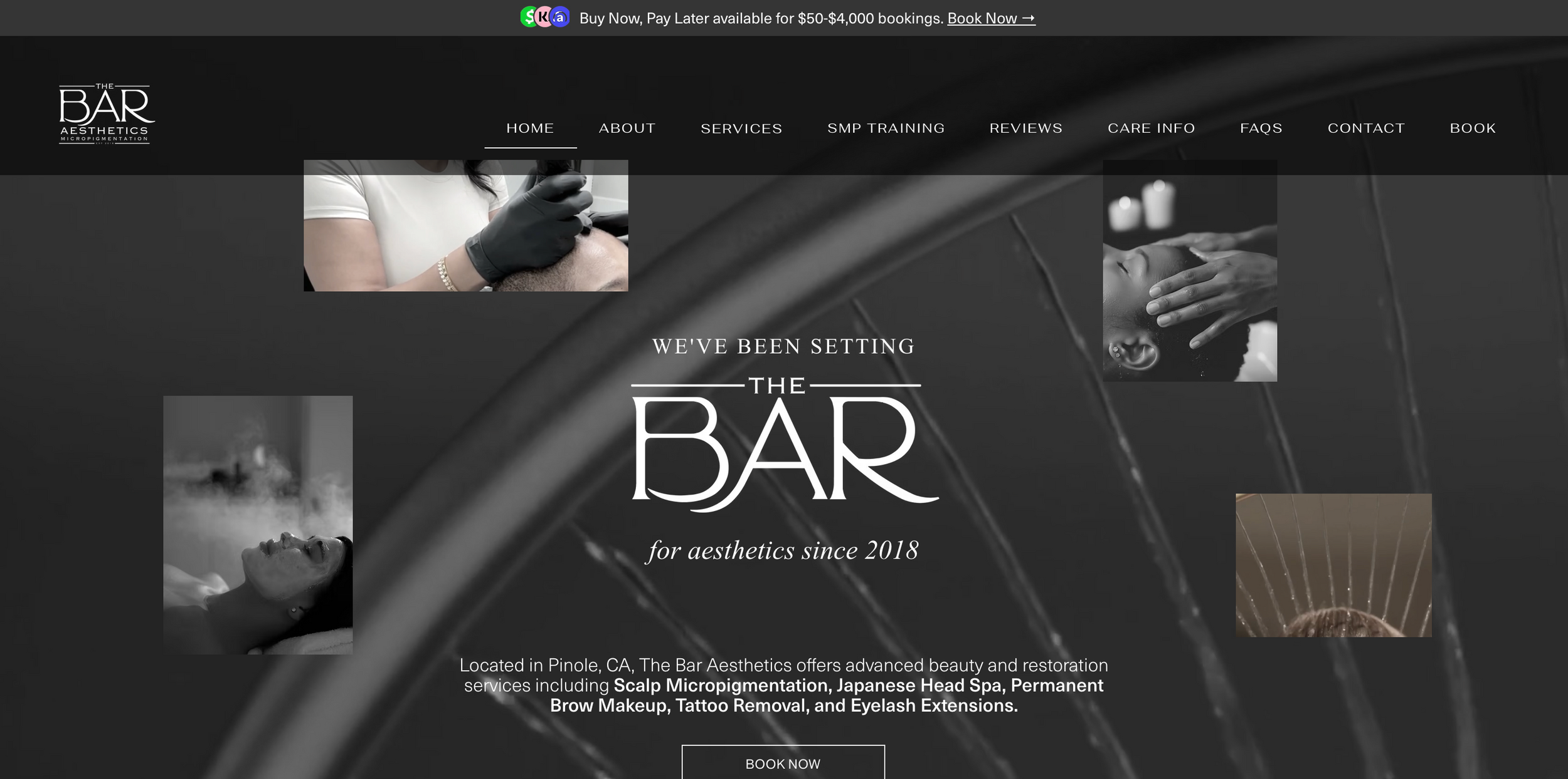 The Bar Aesthetics Scalp Micropigmentation in Pinole, CA