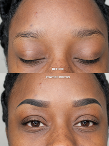 The Bar Aesthetics Scalp Micropigmentation in Pinole, CA (3)