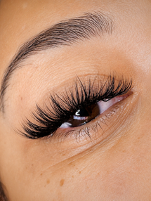 The Bar Aesthetics Scalp Micropigmentation in Pinole, CA (5)