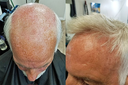 Hair 180 Enhancement in Beaumont, TX (6)