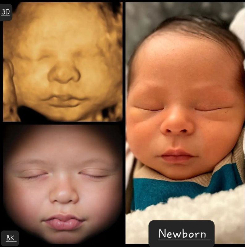 A Little Insight 3D 4D 5D Ultrasound in Vacaville, CA