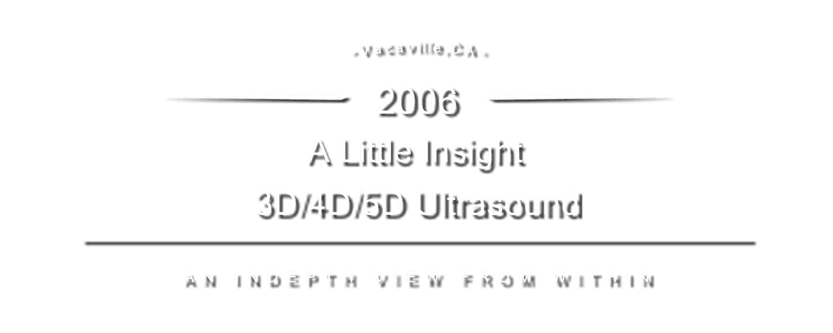 A Little Insight 3D 4D 5D Ultrasound in Vacaville, CA (2)