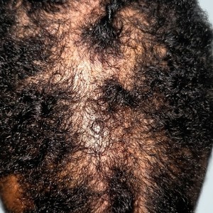 Golden Locs Lounge in Lauderhill, FL (2)