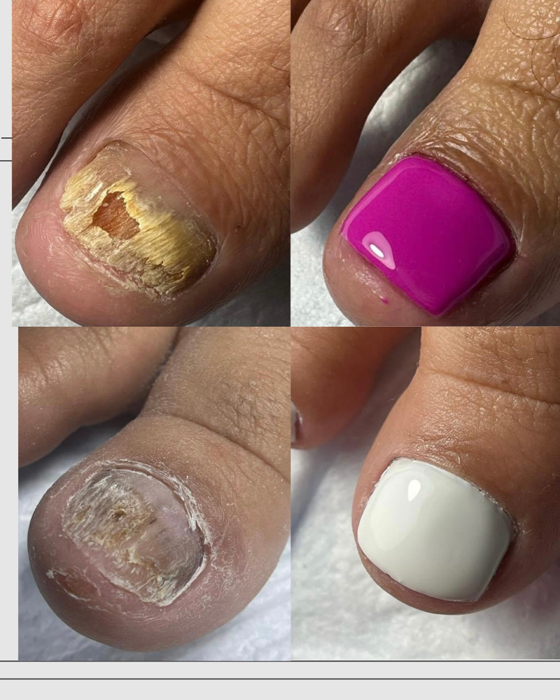 Wellness Pedicures in Los Angeles, CA