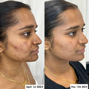 Belle Choses Skin in Hazlet, NJ (6)