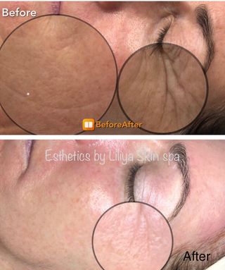 Esthetics by Liliya Skin Spa in Mequon, WI (6)
