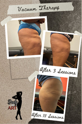 BODY BY ART in Atlanta, TX (3)