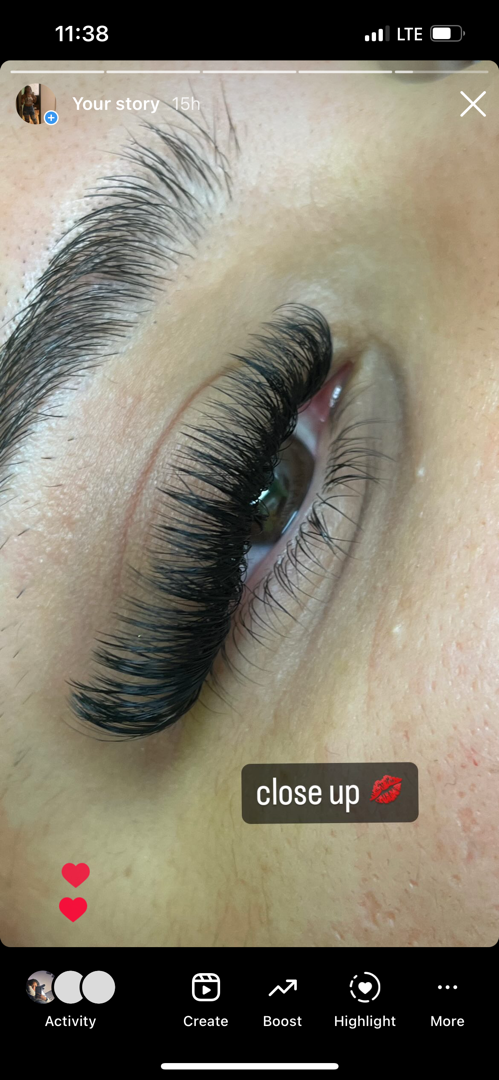 Aesthetics Beauty Kiss in Harrisonburg, VA