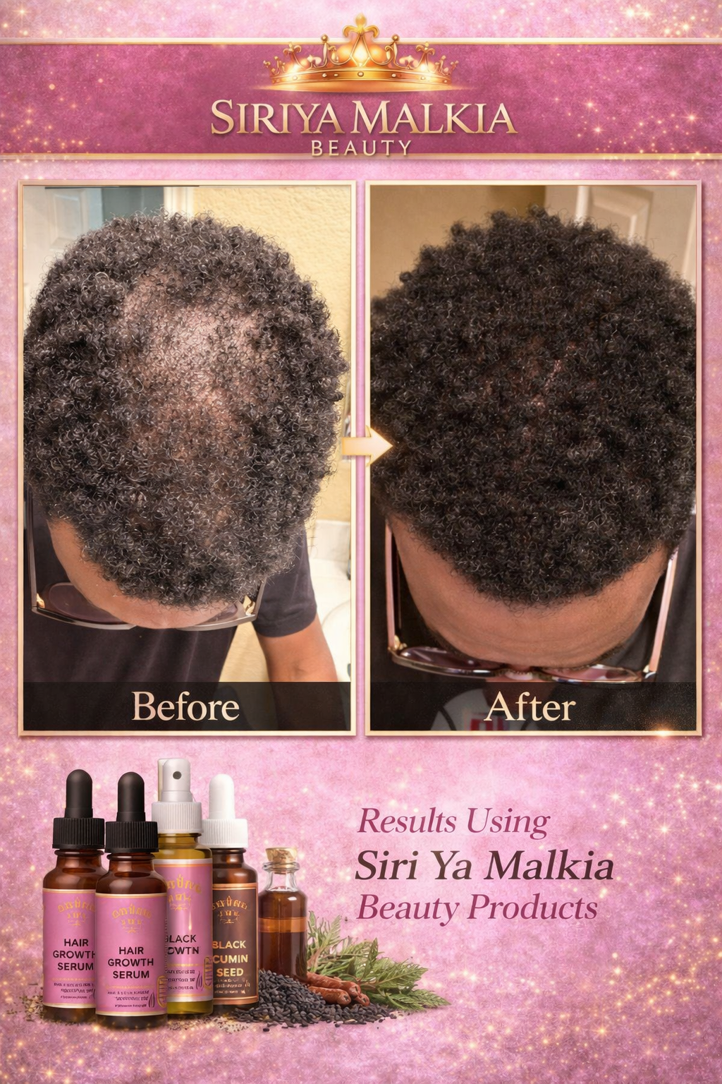 Siri Ya Malkia Hair Restoration and Hair Growth beauty supply in Los Angeles, CA (5)