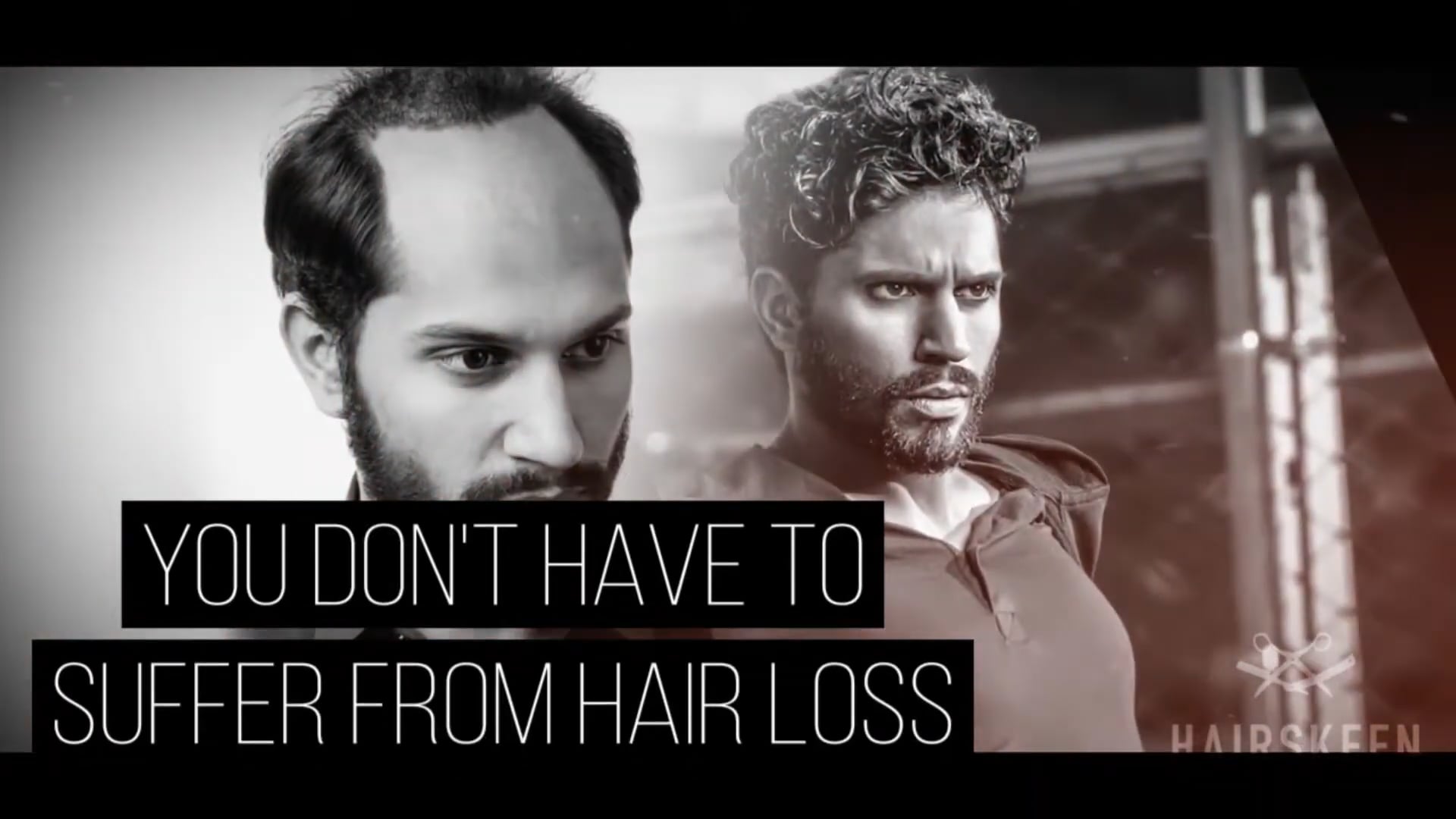 Him|Her Salon & Hair Restoration in South Pasadena, CA (2)
