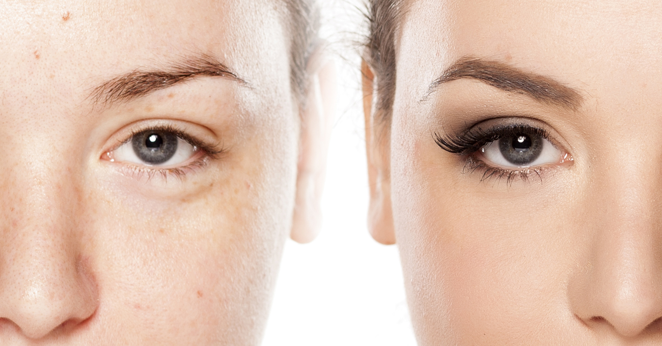 Infinique Skin & Spa LLC in Appleton, WI