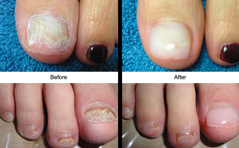 Medical Pedicures by Monica in Loxahatchee, FL