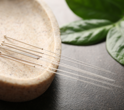 Essence Acupuncture Wellness of San Antonio in Castle Hills, TX (2)