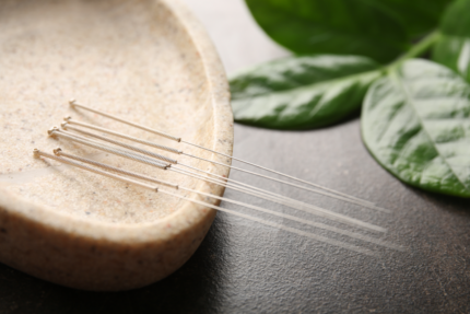 Essence Acupuncture Wellness of San Antonio in Castle Hills, TX (5)