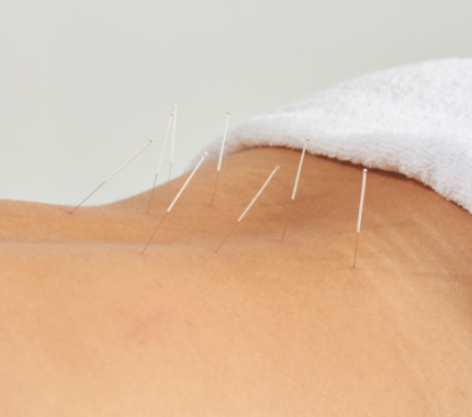 Essence Acupuncture Wellness of San Antonio in Castle Hills, TX (6)