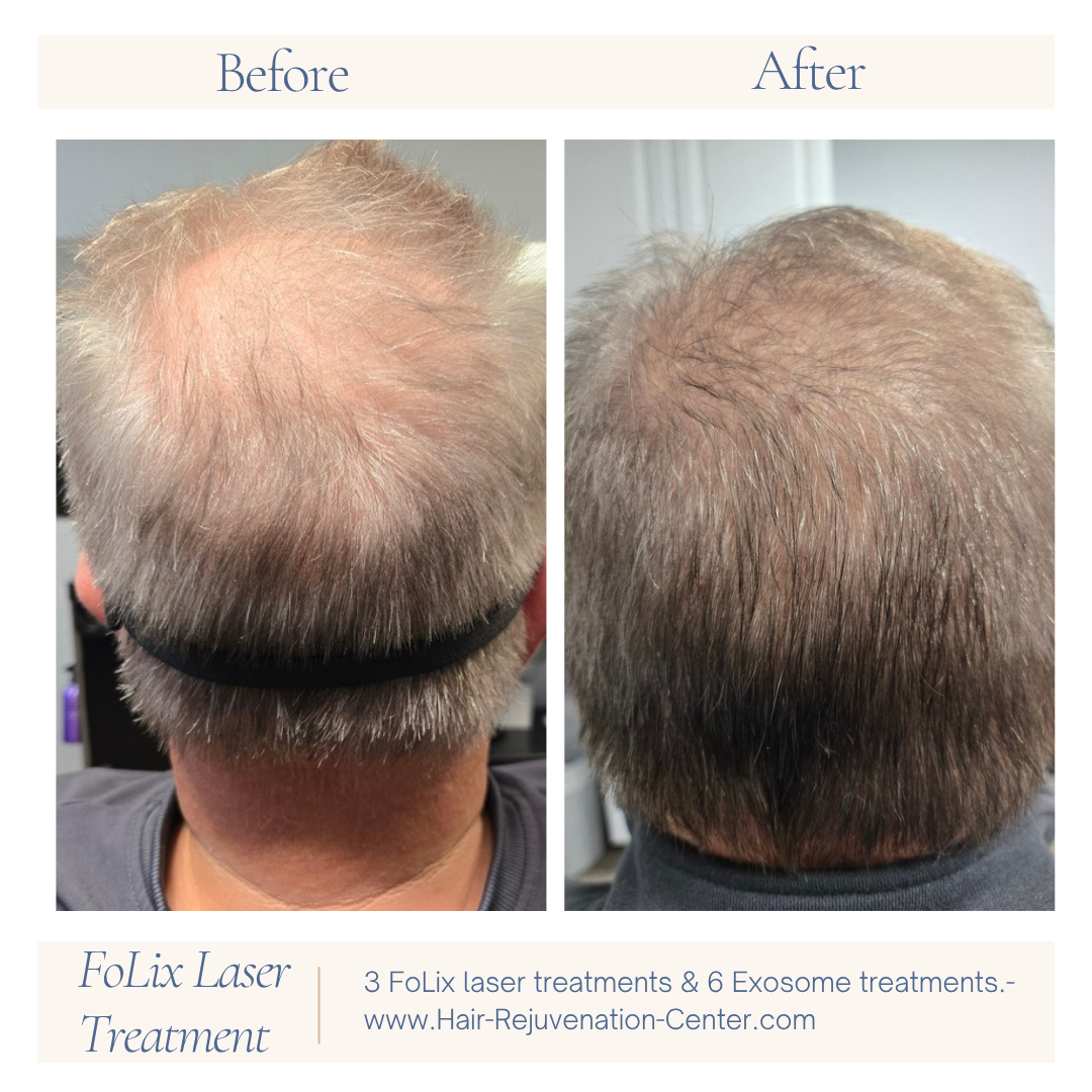 Hair Rejuvenation Center in Evansville, IN (2)